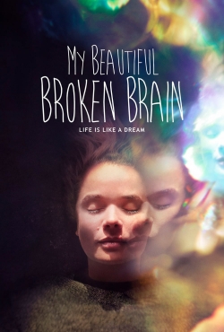 My Beautiful Broken Brain-fmovies